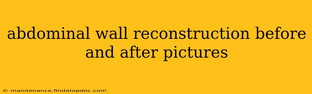 abdominal wall reconstruction before and after pictures