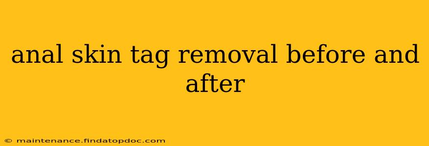 anal skin tag removal before and after