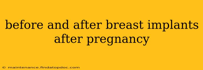 before and after breast implants after pregnancy