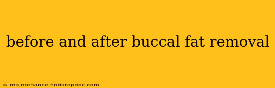before and after buccal fat removal