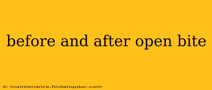before and after open bite