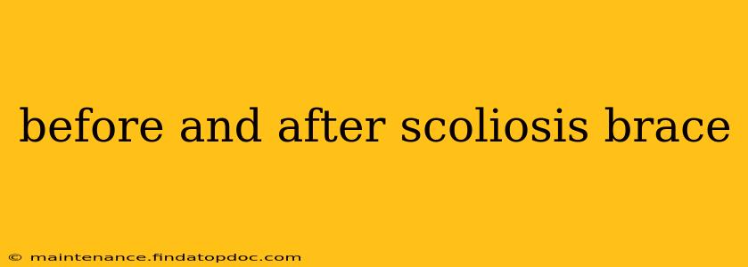 before and after scoliosis brace