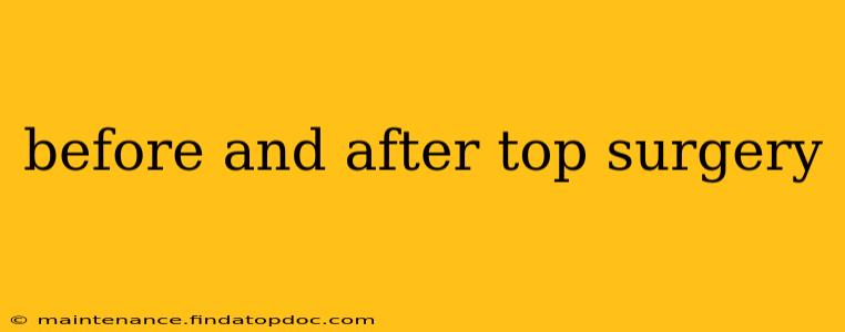 before and after top surgery