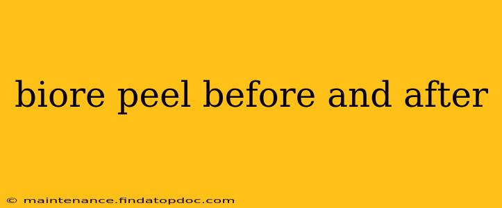biore peel before and after
