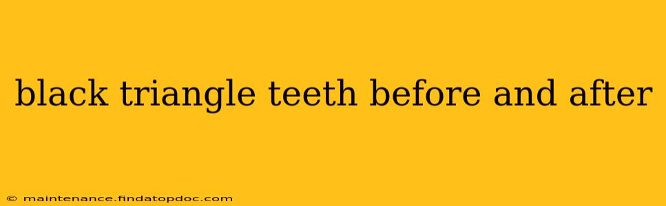 black triangle teeth before and after