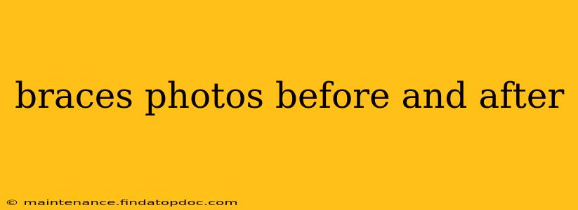 braces photos before and after