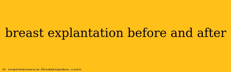 breast explantation before and after