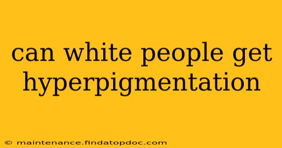 can white people get hyperpigmentation