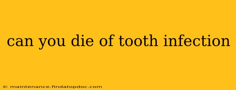 can you die of tooth infection
