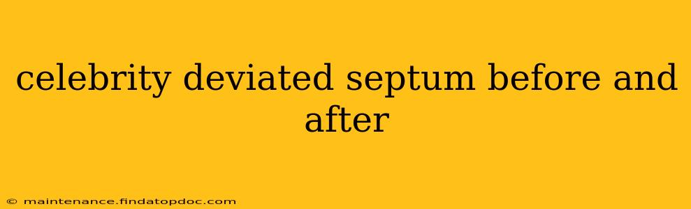 celebrity deviated septum before and after