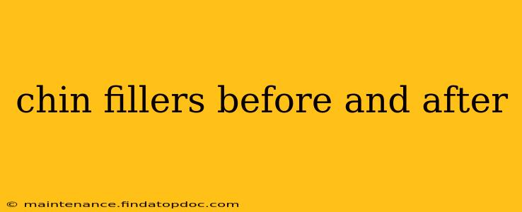 chin fillers before and after