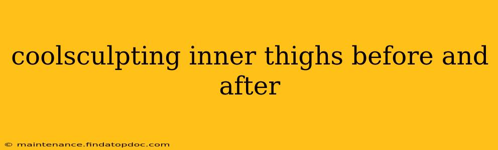 coolsculpting inner thighs before and after