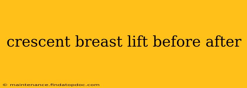 crescent breast lift before after
