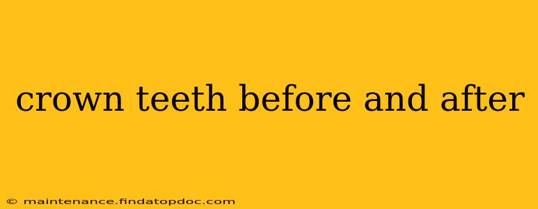 crown teeth before and after