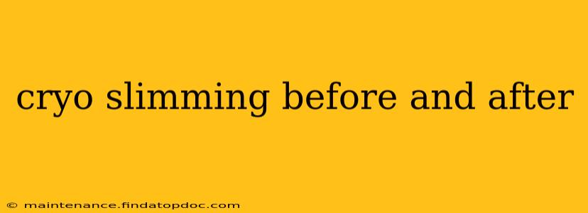 cryo slimming before and after