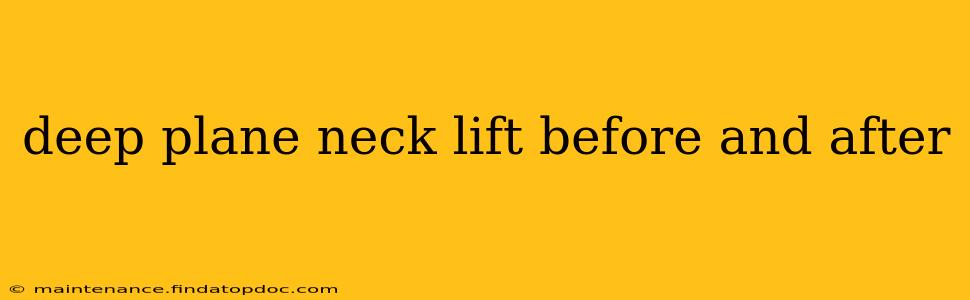 deep plane neck lift before and after