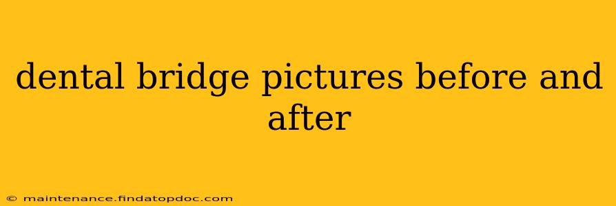 dental bridge pictures before and after