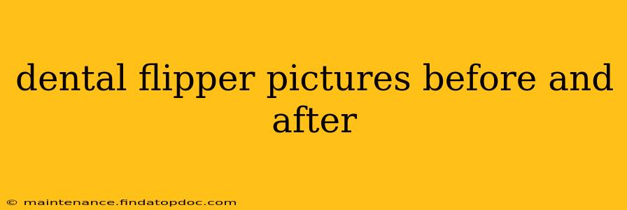 dental flipper pictures before and after