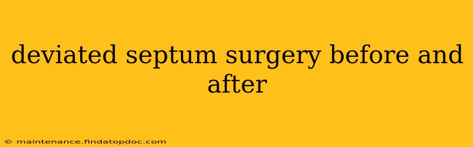 deviated septum surgery before and after