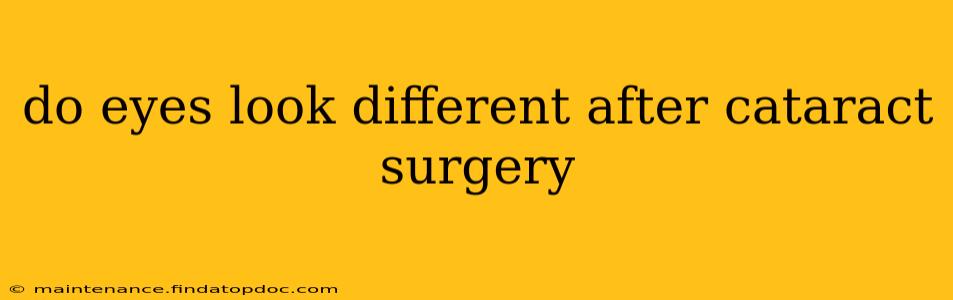do eyes look different after cataract surgery