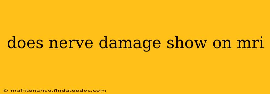 does nerve damage show on mri