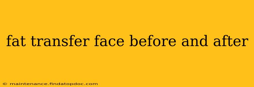 fat transfer face before and after