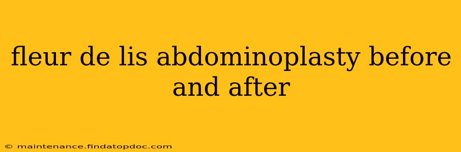 fleur de lis abdominoplasty before and after