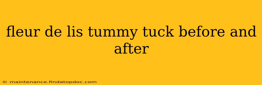 fleur de lis tummy tuck before and after