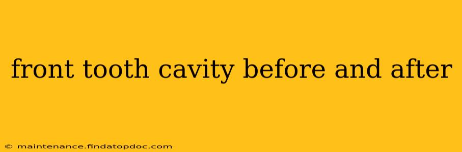 front tooth cavity before and after