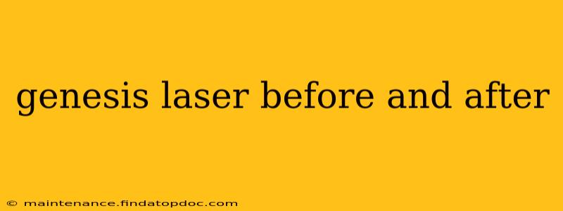 genesis laser before and after