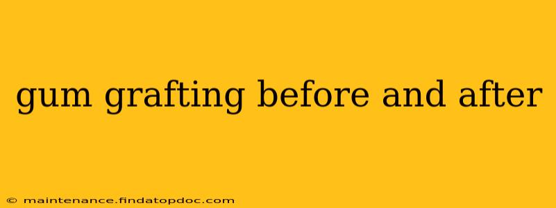 gum grafting before and after