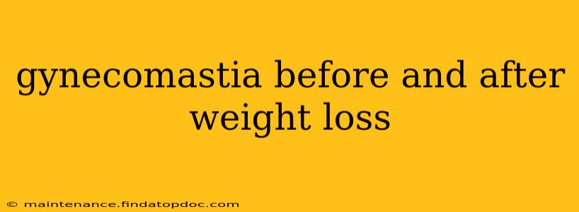 gynecomastia before and after weight loss