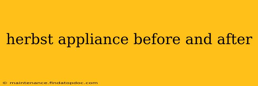 herbst appliance before and after