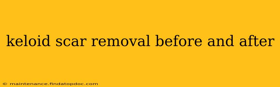 keloid scar removal before and after