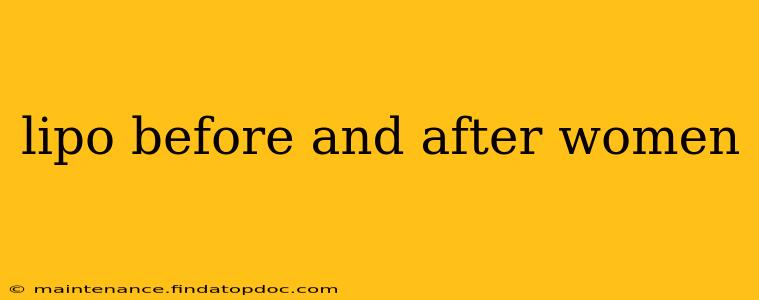 lipo before and after women