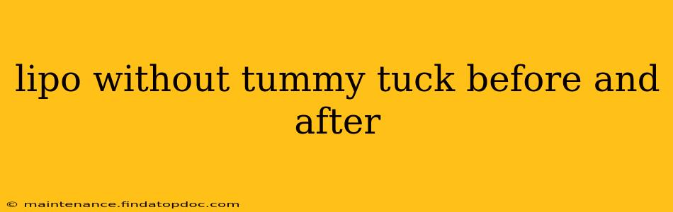 lipo without tummy tuck before and after