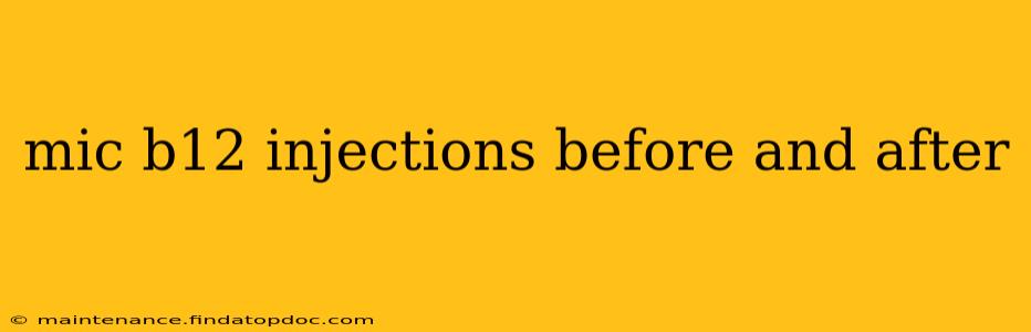 mic b12 injections before and after