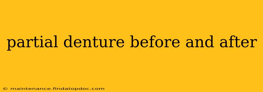 partial denture before and after