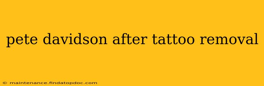 pete davidson after tattoo removal