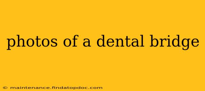 photos of a dental bridge