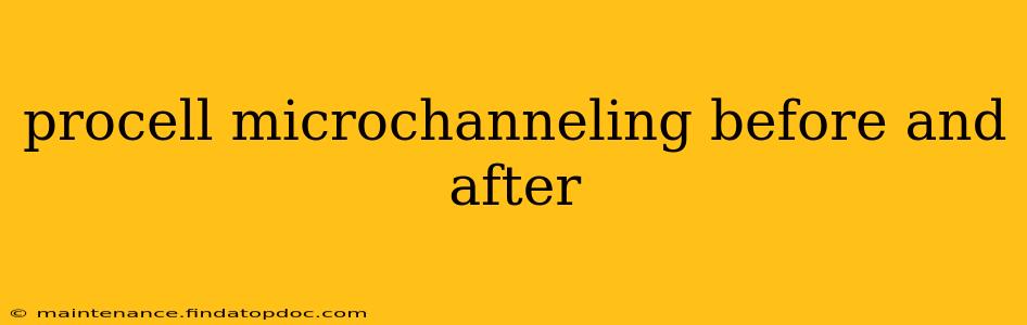 procell microchanneling before and after
