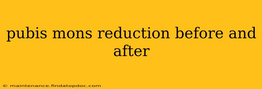 pubis mons reduction before and after