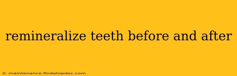 remineralize teeth before and after