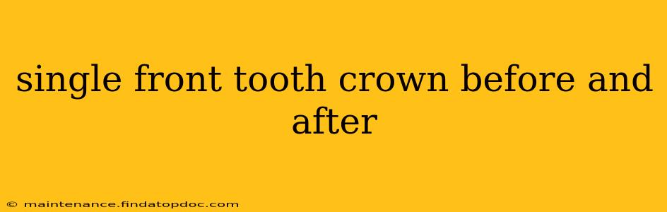 single front tooth crown before and after