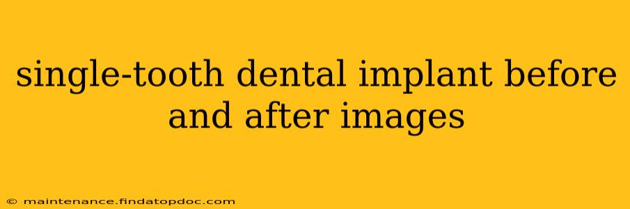 single-tooth dental implant before and after images
