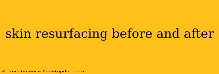 skin resurfacing before and after