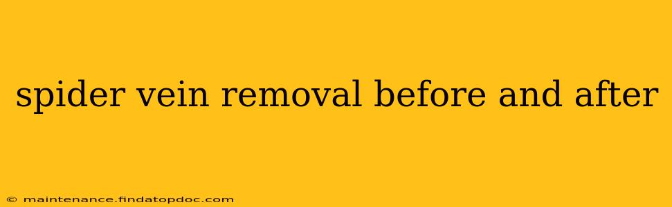 spider vein removal before and after