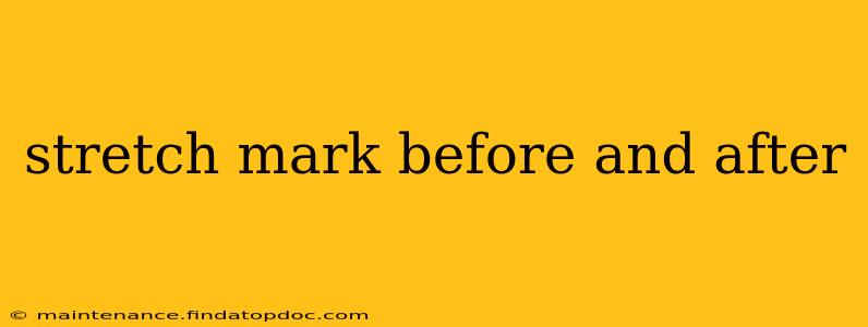 stretch mark before and after