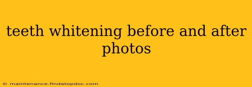 teeth whitening before and after photos