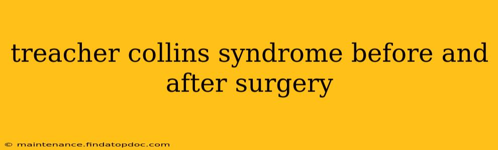 treacher collins syndrome before and after surgery